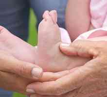 Foot deformacija pri otrocih