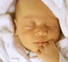 Simptomi zlatenice pri novorojenčkih